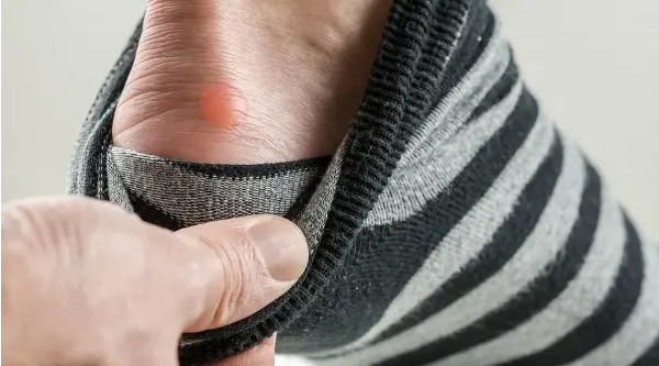 shion Fix Friday: Preventing and Treating Blisters | MWS